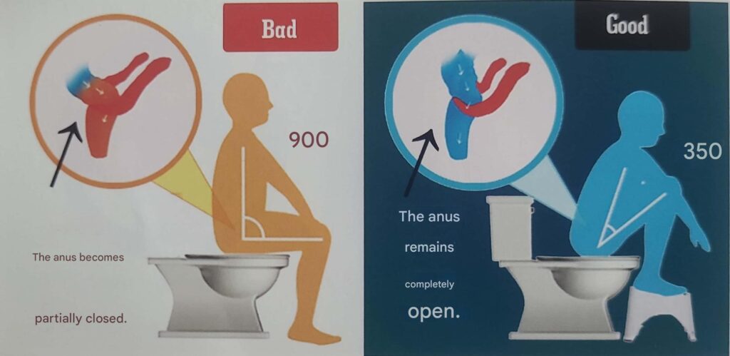 Natural Remedies for Constipation: Best Way to Relieve Constipation at Home